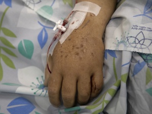 Niepokojące dane resortu zdrowia. Kolejny rekord zakażeń