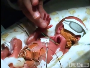 Czy na tym polega braterstwo, że przewidujemy możliwość aborcji aż do końca ciąży? Francuski Marsz dla Życia i Rodziny