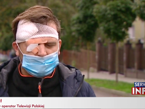 „Kopnął w głowę tak, że uderzyłem w chodnik…” Pobity operator TVP zabrał głos 