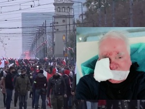 Nowe informacje ws. postrzelonego fotografa TS Tomasza Gutrego. Pan Tomek został przesłuchany przez policję