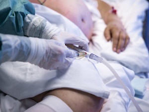 Polska: Ponowny skok zakażeń i zgonów. Liczba potwierdzonych zakażeń przekroczyła milion