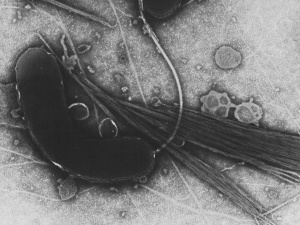 Już 700 ofiar epidemii cholery