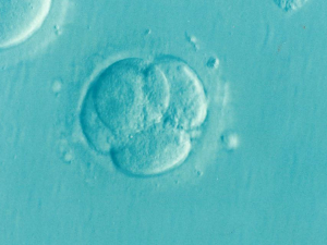 Ekspert: To narzucanie aborcji na żądanie