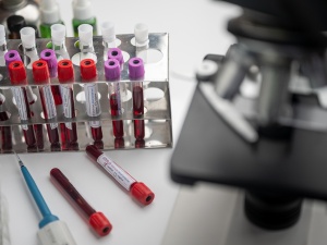 Przełom w diagnostyce raka. Nowatorskie badanie może zwiększyć szansę pacjentów na przeżycie