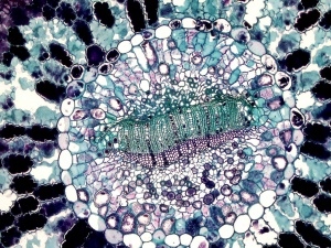 Nowy nanomateriał niszczy komórki raka i oszczędza zdrowe tkanki