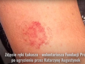 Nieprawdopodobne. „Babcia Kasia” ugryzła wolontariusza Fundacji Pro – Prawo do życia? [WIDEO]