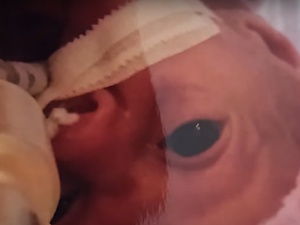 Każde życie jest cudem. Od lekarki usłyszeliśmy, że to straszne, że takie dzieci jak Jagódka przeżywają
