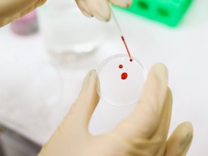 Oficjalnie: Bezpośrednią przyczyną śmierci 27-latki był nie koronawirus, a sepsa