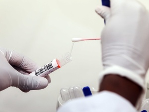 Pilne! Państwowy Zakład Higieny określił polski test na koronawirusa jako w 100% skuteczny