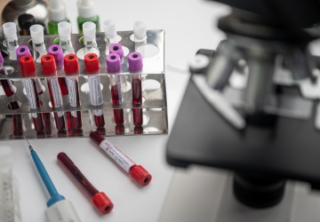 Przełom w diagnostyce raka. Nowatorskie badanie może zwiększyć szansę pacjentów na przeżycie