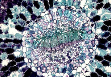 Nowy nanomateriał niszczy komórki raka i oszczędza zdrowe tkanki