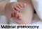 Przełom w diagnostyce wrodzonej wady stawów biodrowych u dzieci i niemowląt dzięki polskim informatykom