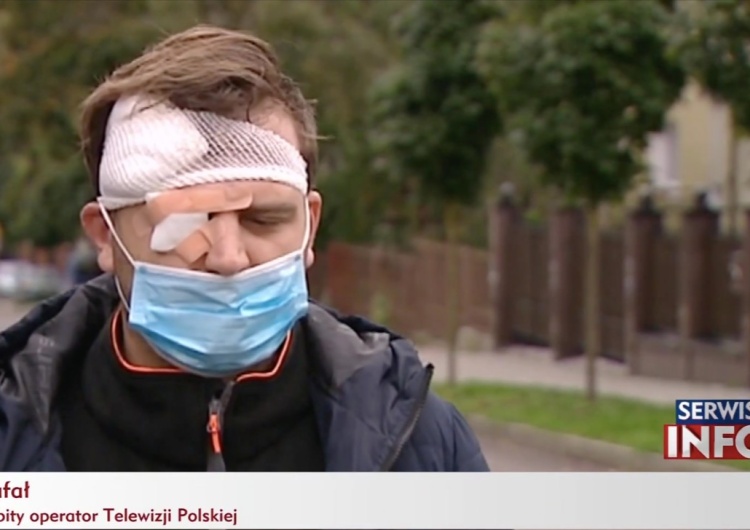 „Kopnął w głowę tak, że uderzyłem w chodnik…” Pobity operator TVP zabrał głos
