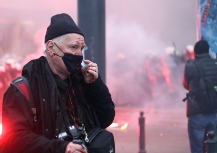 Tomasz Gutry [TYLKO U NAS] „Założono mi metalową płytkę”. Kiedy Tomasz Gutry opuści szpital?