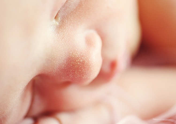 noworodek Hospicja perinatalne, wsparcie medyczne, leczenie prenatalne. Program 