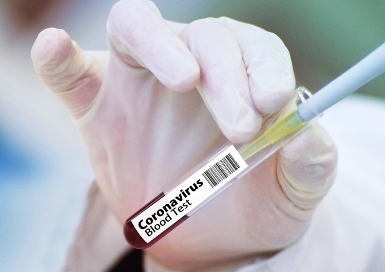  Szczepionka Pfizera działa słabiej przeciw nowej mutacji koronawirusa? 