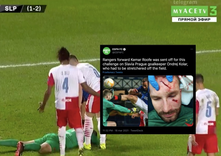  [Video] Dramatyczny faul podczas meczu. Piłkarz został trafiony korkiem prosto w twarz