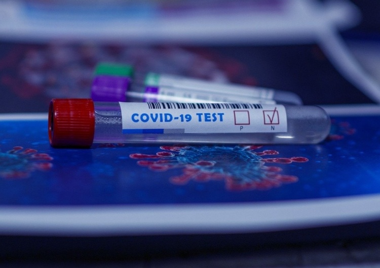 Test na koronawirusa Ponad pięć tysięcy zakażeń koronawirusem ostatniej doby