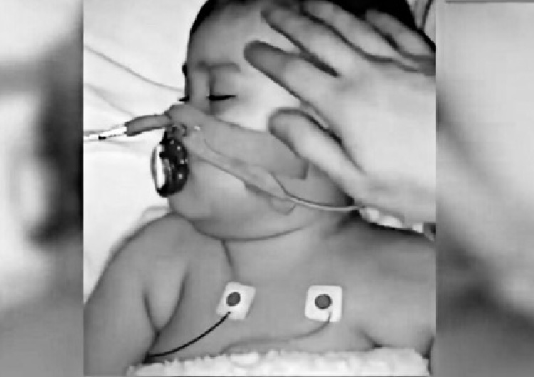  Nie żyje Alfie Evans