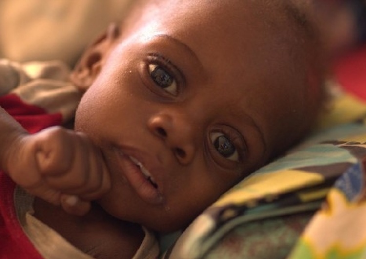  Głód zabija dzieci w Afryce Wschodniej i Południowej! UNICEF Polska apeluje o pomoc