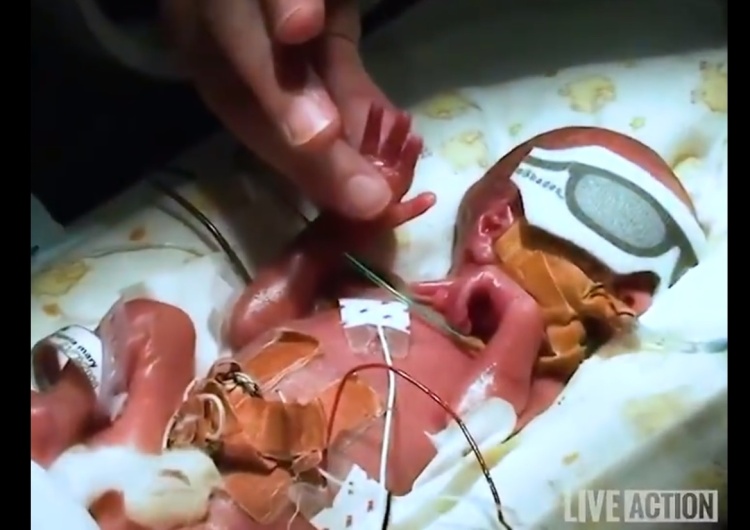  [video] Zdrowe dziecko urodziło się w 24. tygodniu ciąży. Facebook miał ocenzurować film