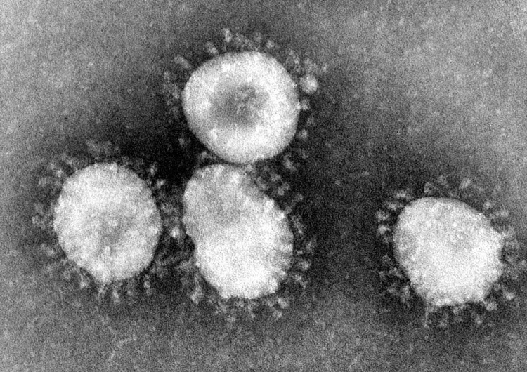  Ekspert GIS: Śmiertelność w przypadku koronawirusa jest mniejsza niż w przypadku wirusów SARS i MERS