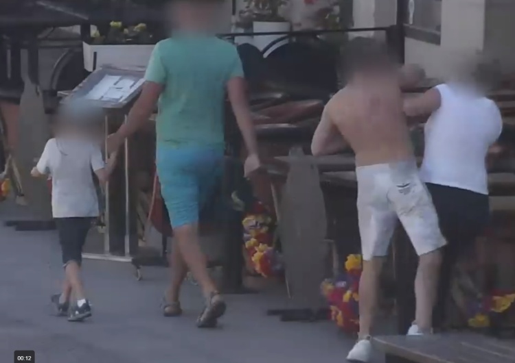 Brutalny atak w centrum Warszawy. Agresor uderzył spacerującą kobietę w twarz i złamał jej oczodół