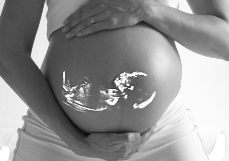 Skitterphoto W tym roku w Polsce wykonano 1100 aborcji. Kolejny rok z rzędu ani jednej na Podkarpaciu