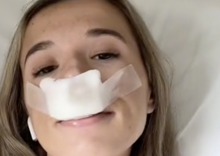 Fiore Ciminello Znana tiktokerka poddała się operacji plastycznej nosa, aby jej dzieci