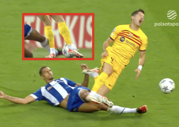 Robert Lewandowski kontuzjowany Fatalne wieści dla reprezentacji Polski. Poważna kontuzja wyklucza Roberta Lewandowskiego [WIDEO]
