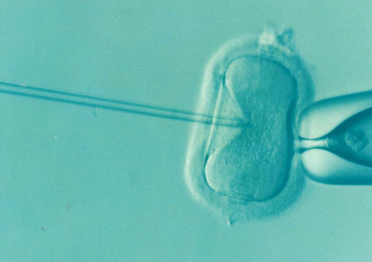 zdjęcie poglądowe Kościół wobec procedury in vitro: Nie chodzi o argumenty religijne, ale racje obiektywne