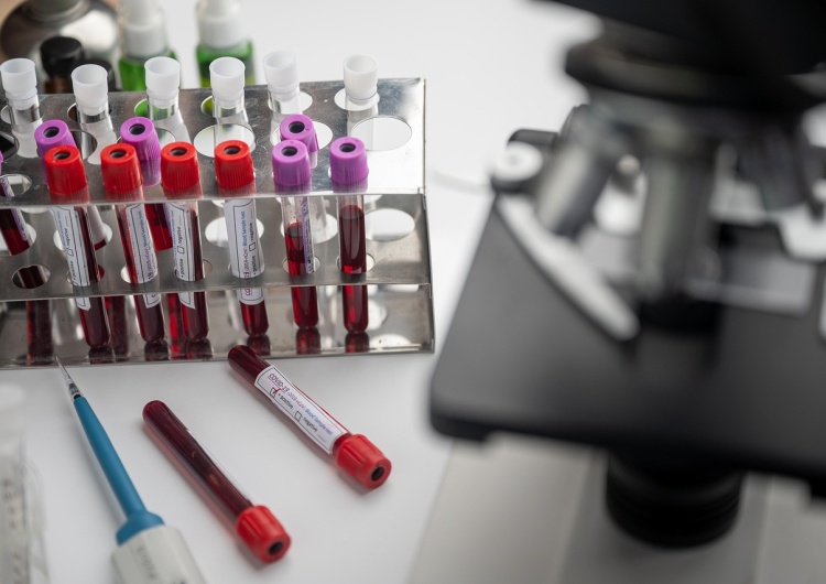 Zdjęcie ilustracyjne Przełom w diagnostyce raka. Nowatorskie badanie może zwiększyć szansę pacjentów na przeżycie