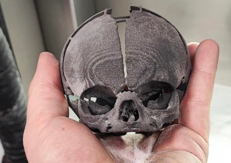Wydruk 3D czaszki dziecka Naukowy wieczór z dr. Kaweckim: To czaszka 3D noworodka, która uratowała życie dziecku!