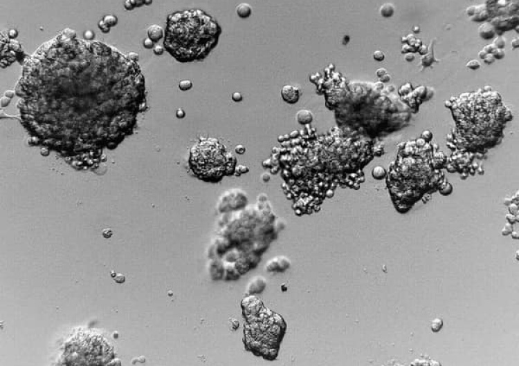 Komórki rozwijające się w hydrożelu Naukowy wieczór z dr. Kaweckim: Polacy opracowali pierwszy taki żel na świecie do hodowli ludzkich komórek 3D